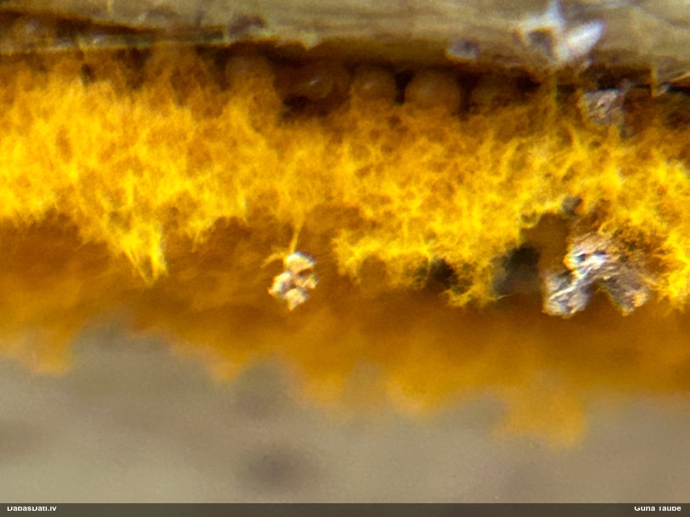 Trihija, hemitrihija (nenoteikta)