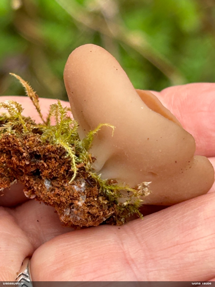 щитовидная дисцина